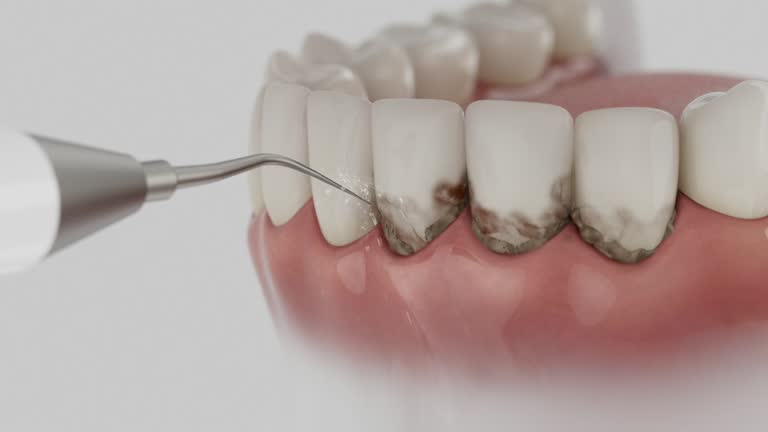 Reliable Emergency Dentist contractor in Rosemount, MN by Smile Center Dentistry
